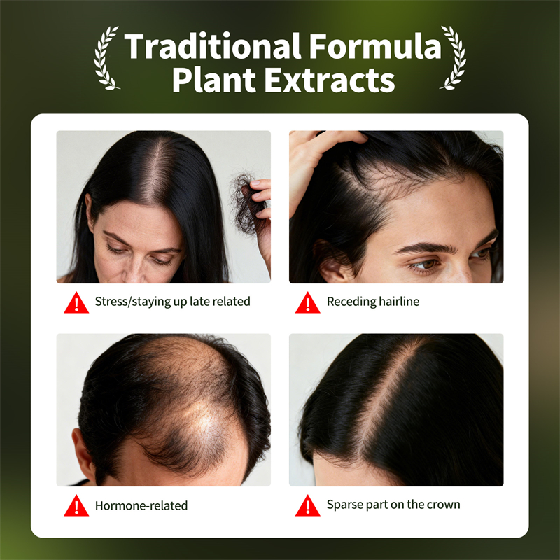 Set Perawatan Rambut Alami Usm - Hair Care Herbal ulasan dan harga
