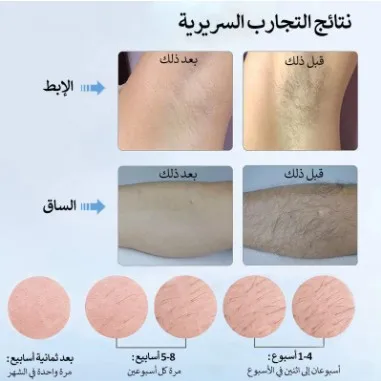 Alat Penghilang Bulu IPL T4 ML - Hair Care Korean ulasan dan harga